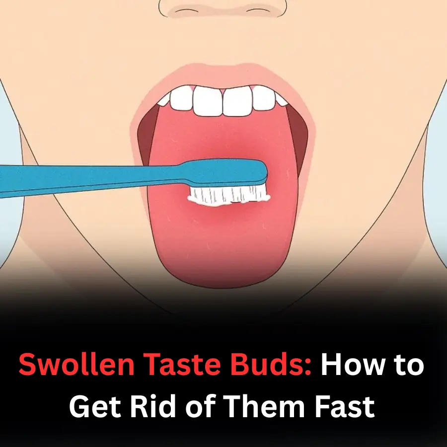 How to Get Rid of a Swollen Taste Bud at Home