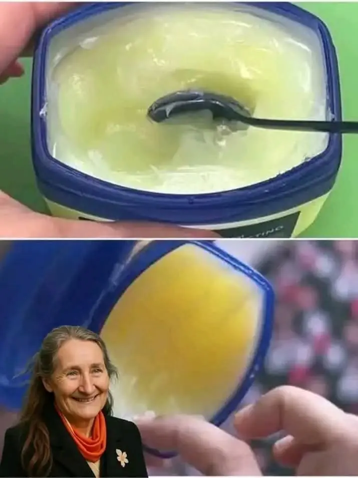 Vaseline, also known as petroleum jelly