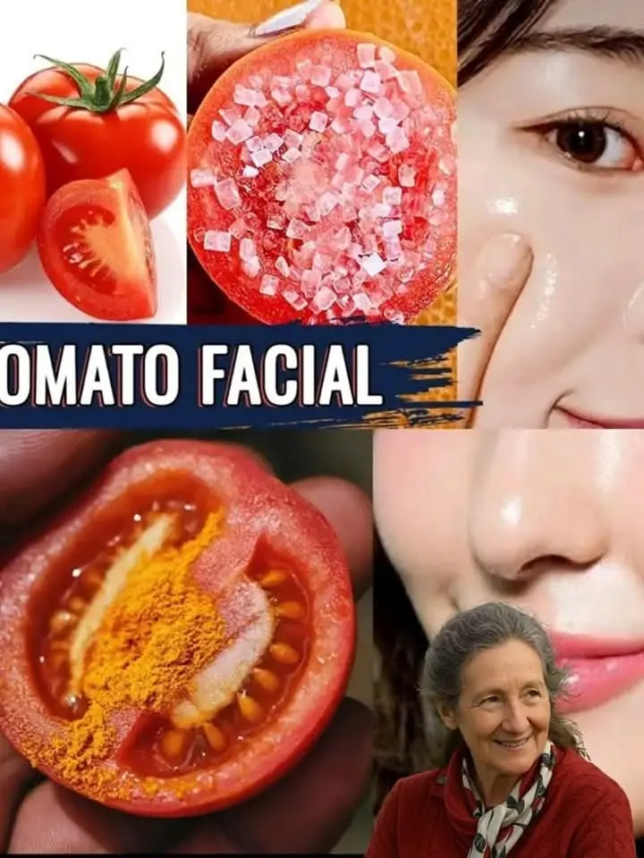 Tomatoes, particularly when it comes to skin whitening, are excellent for the skin