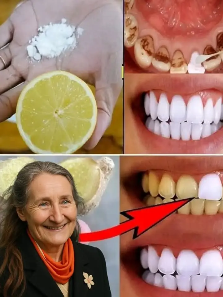 Whiten Teeth & Refresh Your Breath Naturally with Ginger and Baking Soda