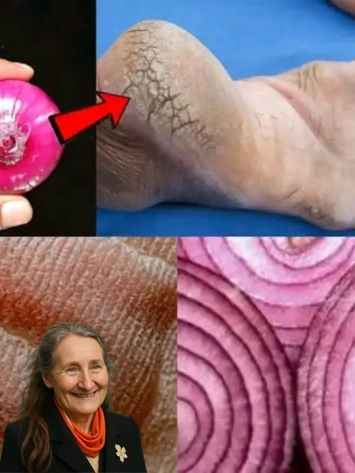 Cracked heels can be uncomfortable and unsightly