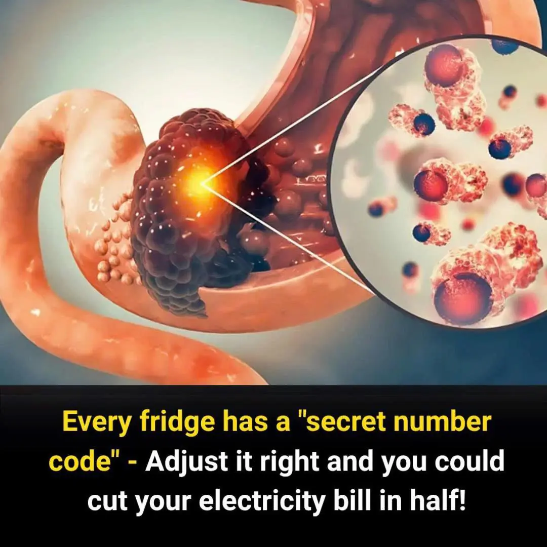 Early Signs of Stomach Cancer You Should Never Ignore