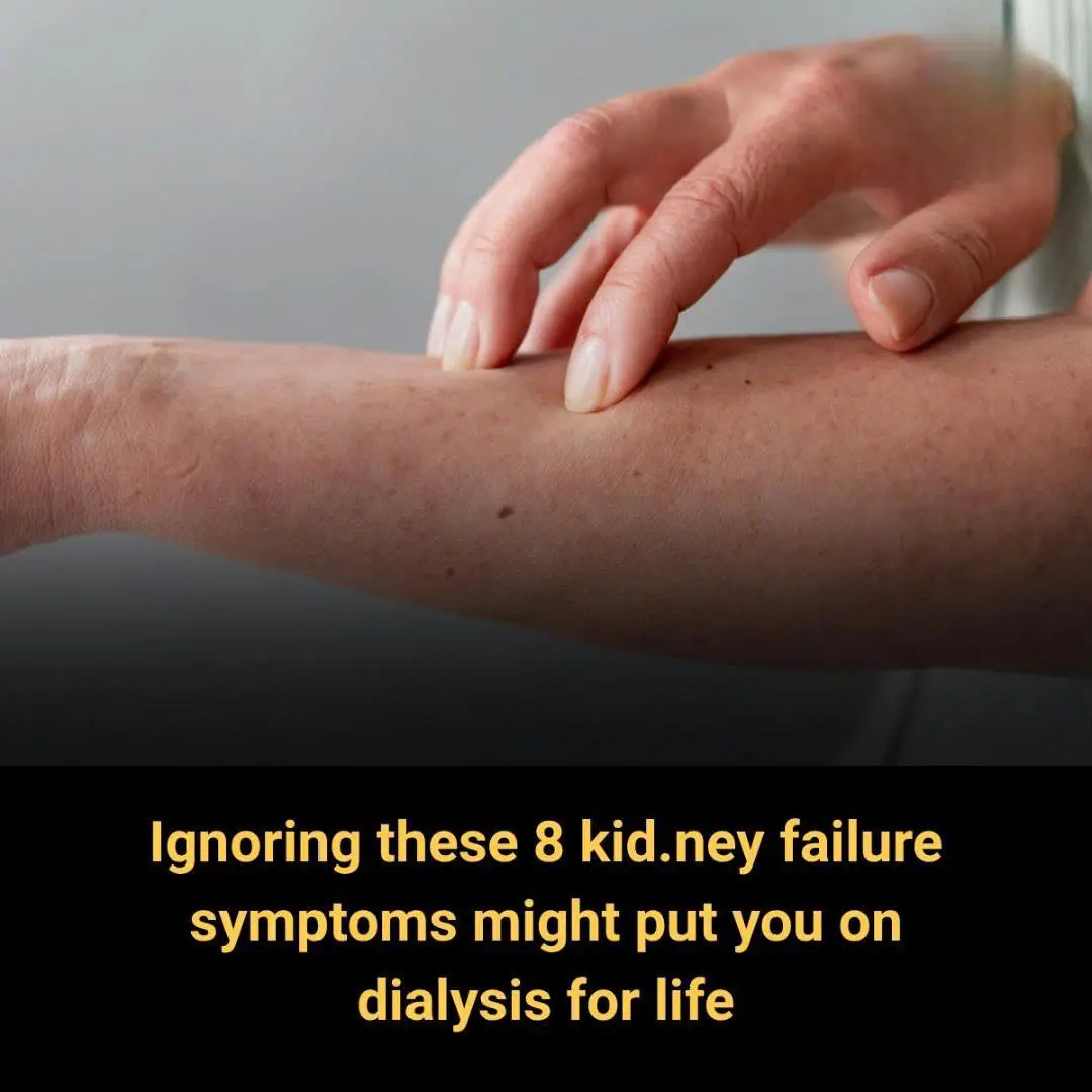 8 Warning Signs of Kidney Failure You Should Never Ignore — Especially If Dialysis May Be Next