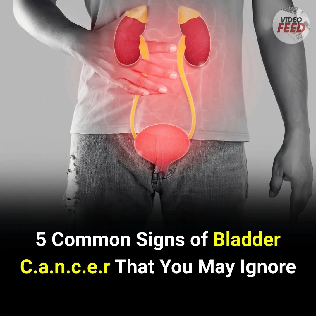 5 Common Signs of Bladder Cancer You Might Overlook
