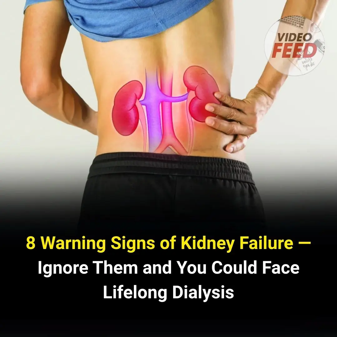 8 Warning Signs of Kidney Failure That Should Never Be Ignored