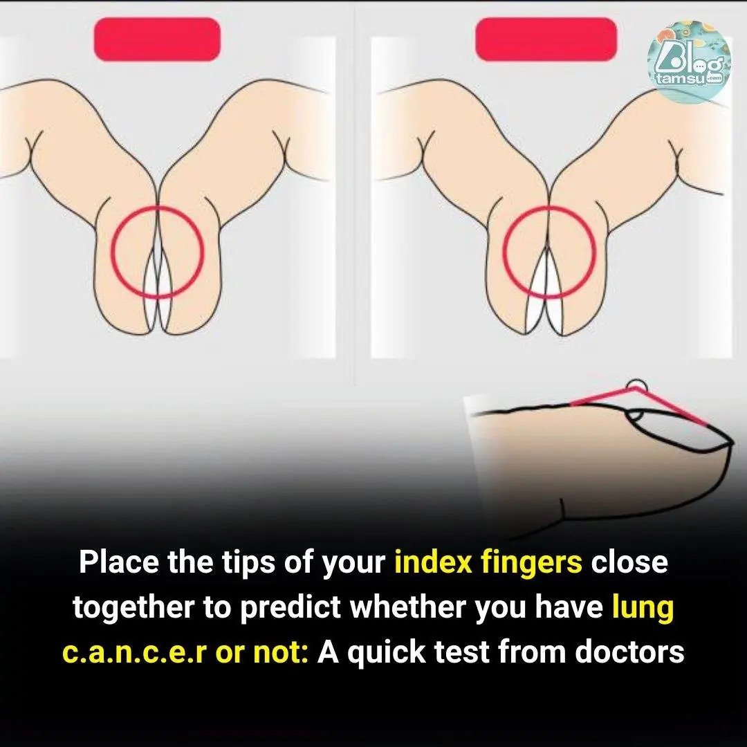 What Your Fingernails Reveal: The Surprising Truth Behind Placing Your Index Fingertips Together
