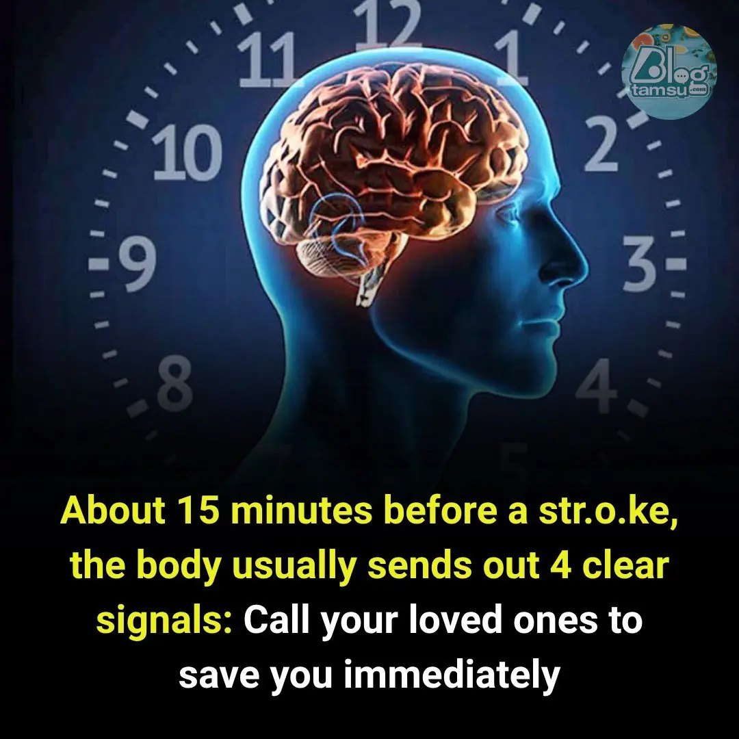 4 Clear Warning Signs Your Body May Show Just 15 Minutes Before a Stroke