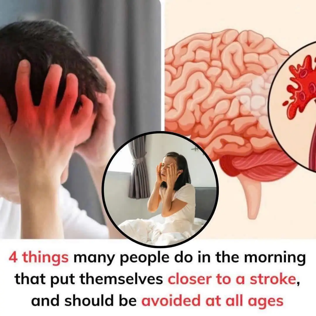 4 Morning Habits That May Quietly Raise Your Stroke Risk—Avoid Them at Any Age
